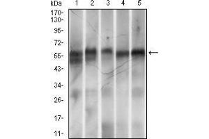 Western blot analysis using Ring1 mouse mAb against MOLT-4 (1), LNCaP (2), Hela (3), HEK-293 (4) and Jurkat (5) cell lysate. (RING1 Antikörper  (AA 79-263))