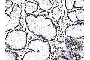 IHC analysis of RAD18 using anti-RAD18 antibody (ABIN7599364). (RAD18 Antikörper  (AA 1-408))