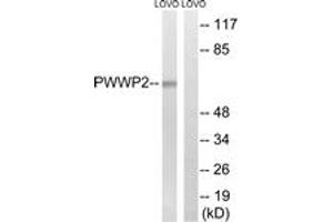 Western blot analysis of extracts from LOVO cells, using PWWP2B Antibody. (PWWP2B Antikörper  (AA 268-317))