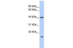 SLAIN1 antibody used at 1 ug/ml to detect target protein. (SLAIN1 Antikörper  (Middle Region))
