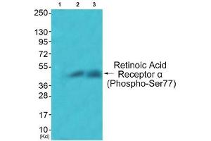 Western blot analysis of extracts from JK cells (Lane 2) and COS7 cells (Lane 3), using Retinoic Acid Receptor α (Phospho-Ser77) Antibody.