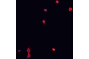 ABIN6267023 staining K-562 cells by IF/ICC. (Nibrin Antikörper  (pSer278))