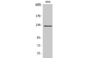 Western Blotting (WB) image for anti-PTK2 Protein tyrosine Kinase 2 (PTK2) (Thr435) antibody (ABIN3180042) (FAK Antikörper  (Thr435))