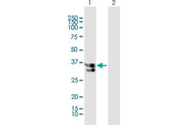 KATNA1 Antikörper  (AA 1-311)