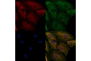 ABIN6257890 and ABIN6274946 staining  cells by IF/ICC. (CAGE1 Antikörper  (C-Term))
