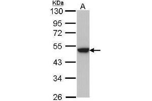 WB Image Sample (30 ug of whole cell lysate) A: Hela 10% SDS PAGE antibody diluted at 1:1000 (Keratin 31 Antikörper)