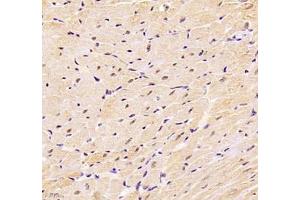 Immunohistochemistry (Paraffin-embedded Sections) (IHC (p)) image for anti-DEAD (Asp-Glu-Ala-As) Box Polypeptide 19B (DDX19B) antibody (ABIN7073694)