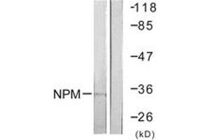 Western blot analysis of extracts from Jurkat cells, using NPM (Ab-199) Antibody. (NPM1 Antikörper  (AA 171-220))