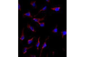 Image no. 3 for anti-KIT Ligand (KITLG) (C-Term) antibody (ABIN357009) (KIT Ligand Antikörper  (C-Term))