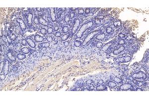 Detection of MPO in Bovine Colon Tissue using Monoclonal Antibody to Myeloperoxidase (MPO) (Myeloperoxidase Antikörper)