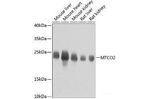 Western blot analysis of extracts of various cell lines using MTCO2 Polyclonal Antibody at dilution of 1:800. (COX2 Antikörper)