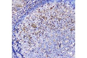 anti-Adenosine Deaminase (ADA) (AA 135-363) antibody