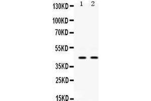 Western Blotting (WB) image for anti-Keratin 19 (KRT19) (AA 334-372), (C-Term) antibody (ABIN3043288) (Cytokeratin 19 Antikörper  (C-Term))