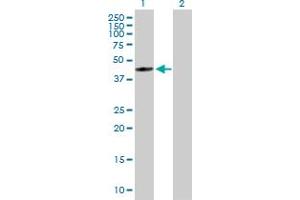 Western Blot analysis of FDFT1 expression in transfected 293T cell line by FDFT1 MaxPab polyclonal antibody. (FDFT1 Antikörper  (AA 1-417))