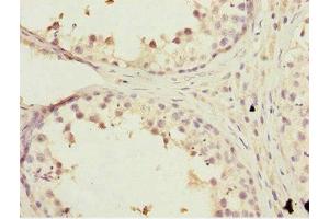Immunohistochemistry of paraffin-embedded human testis tissue using ABIN7157257 at dilution of 1:100 (KBTBD7 Antikörper  (AA 475-684))
