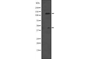 Western blot analysis of MCM9 expression in Rat brain tissue lysate ,The lane on the left is treated with the antigen-specific peptide. (MCM9 Antikörper  (C-Term))