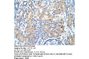 Rabbit Anti-UROD Antibody  Paraffin Embedded Tissue: Human Kidney Cellular Data: Epithelial cells of renal tubule Antibody Concentration: 4. (UROD Antikörper  (N-Term))