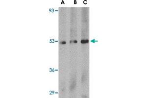Western blot analysis of PLXDC1 in human liver tissue lysate with PLXDC1 polyclonal antibody  at (A) 0. (PLXDC1 Antikörper  (C-Term))