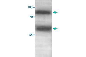 Western blot analysis of human fetal skeletal muscle lysate with ADAMTS1 polyclonal antibody  at 1 : 500 dilution. (ADAMTS1 Antikörper  (C-Term))