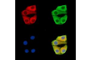 ABIN7096380 and ABIN7100444 staining Hela cells by IF/ICC. (PMPCA Antikörper)