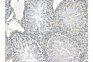 anti-Poly (ADP-Ribose) Polymerase Family, Member 14 (PARP14) antibody