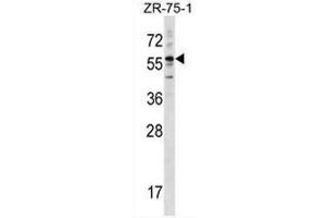 KRT3 Antibody (Center) western blot analysis in ZR-75-1 cell line lysates (35µg/lane).