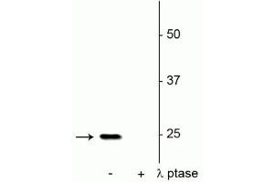 Western blot of rat hippocampal lysate showing specific immunolabeling of the ~25 kDa SNAP25 phosphorylated at Ser187 in the first lane (-). (SNAP25 Antikörper  (pSer187))