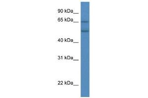 WB Suggested Anti-CYP2S1 Antibody Titration:  0. (CYP2S1 Antikörper  (C-Term))