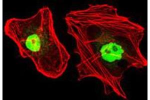 Image no. 3 for anti-Replication Protein A1, 70kDa (RPA1) antibody (ABIN1500741) (RPA1 Antikörper)