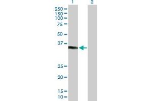 Western Blot analysis of KCTD7 expression in transfected 293T cell line by KCTD7 MaxPab polyclonal antibody. (KCTD7 Antikörper  (AA 1-289))