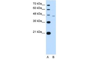 WB Suggested Anti-SMAD7 Antibody Titration:  1. (SMAD7 Antikörper  (N-Term))