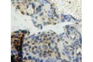 IHC-P analysis of Ovary tissue, with DAB staining. (BCL9 Antikörper  (AA 1119-1328))