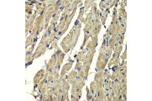 Immunohistochemistry of paraffin-embedded mouse heart using FXN antibody. (Frataxin Antikörper  (AA 42-210))