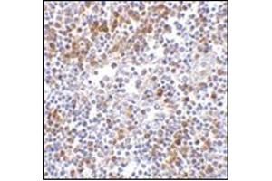Immunohistochemistry of MDA5 in human lymph node tissue with this product at 5 μg/ml. (IFIH1 Antikörper  (C-Term))