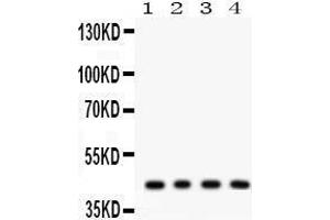 Anti- ADIPOR1 Picoband antibody, Western blotting All lanes: Anti ADIPOR1  at 0. (Adiponectin Receptor 1 Antikörper  (N-Term))