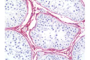 Anti-NGFR / CD271 / p75 antibody IHC staining of human testis.