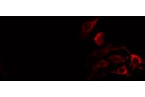 ABIN6274373 staining HT29 cells by IF/ICC. (RHOH Antikörper  (Internal Region))