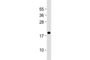 Western blot testing of human PC-3 cell lysate with MEAF6 antibody at 1:2000. (MEAF6 Antikörper  (AA 120-154))