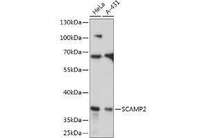 Western blot analysis of extracts of various cell lines, using SC antibody (ABIN7270188) at 1:1000 dilution. (SCAMP2 Antikörper  (AA 1-152))
