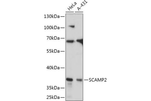 SCAMP2 Antikörper  (AA 1-152)