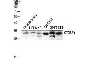 Western Blot (WB) analysis of Mouse Brain HeLa KB SH-SY5Y 293T 3T3 lysis using CTDSP1 antibody. (CTDSP1 Antikörper  (N-Term))