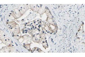 ABIN6278120 at 1/100 staining Human prostate tissue by IHC-P. (TRIM29 Antikörper  (Internal Region))