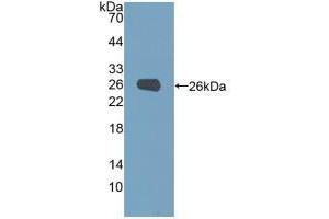 Figure. (Phosphoglucomutase 1 Antikörper  (AA 1-235))