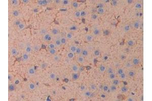 IHC-P analysis of Mouse Cerebrum Tissue, with DAB staining. (IL11RA Antikörper  (AA 59-217))