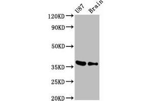 Western Blot Positive WB detected in U87 whole cell lysate 77ouse brain tissue All lanes GAPDH antibody at 0. (Rekombinanter GAPDH Antikörper)