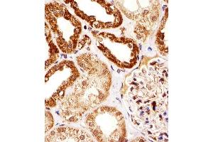 Immunohistochemical analysis of paraffin-embedded H. (SSNA1 Antikörper  (N-Term))