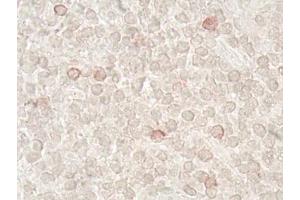 Immunohistochemistry analysis of human tonsil tissue (60x) using LAG-3 (human) recombinant mAb (L4-PL33), at a dilution of 1:50 (LAG3 Antikörper  (N-Term))