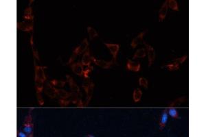 Immunofluorescence analysis of NIH/3T3 cells using GPC4 Polyclonal Antibody at dilution of 1:100. (GPC4 Antikörper)