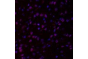 Immunofluorescent analysis of paraformaldehyde-fixed rat brain using,HECTD1 (ABIN7074186) at dilution of 1: 2000 (HECTD1 Antikörper)