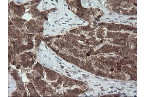 Image no. 8 for anti-Carboxypeptidase A2 (Pancreatic) (CPA2) antibody (ABIN1497598) (Carboxypeptidase A2 Antikörper)
